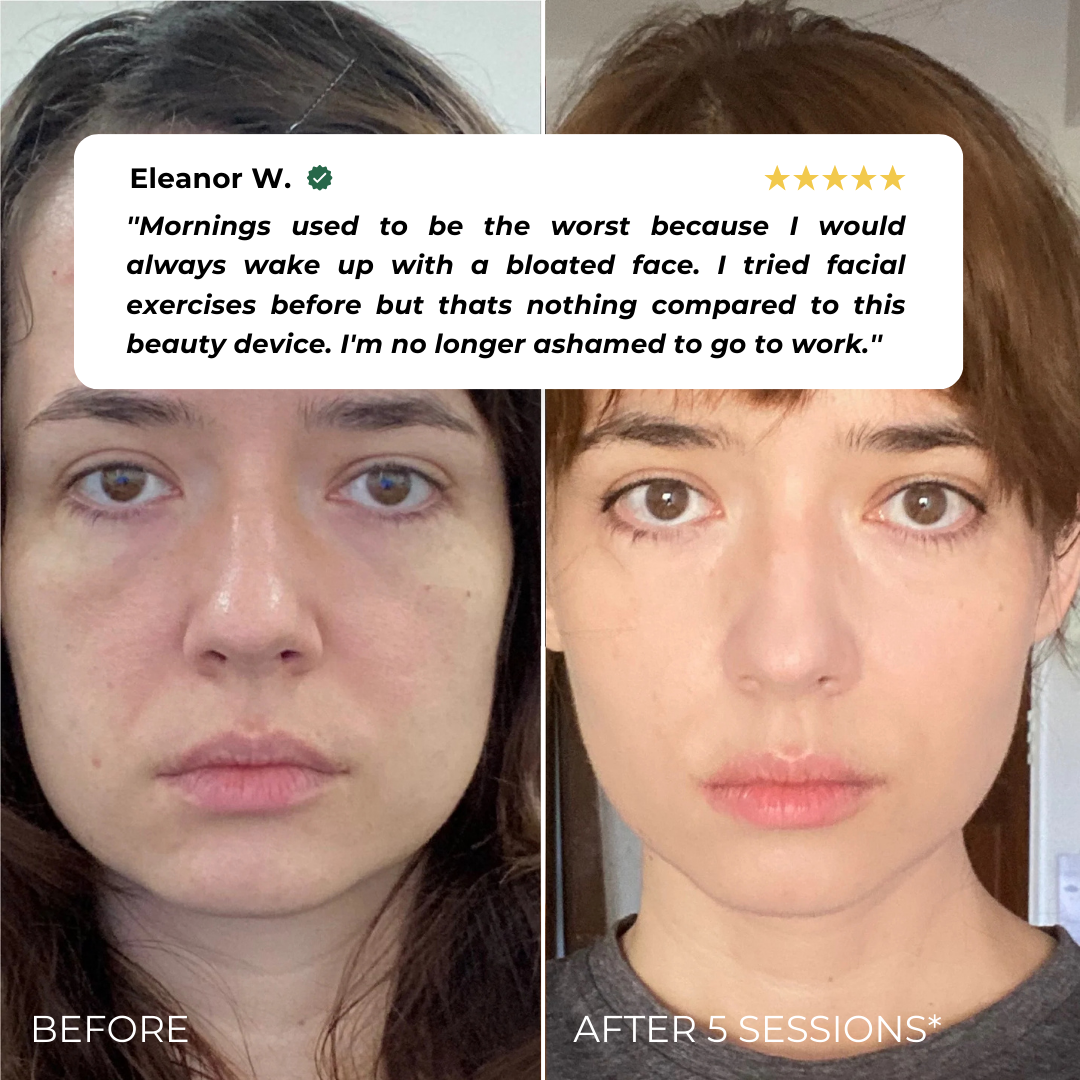 BUEMM K- Beauty Device