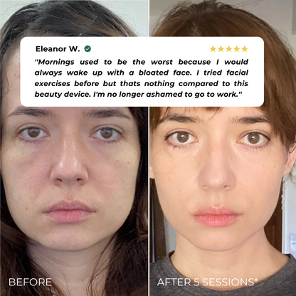 BUEMM K- Beauty Device
