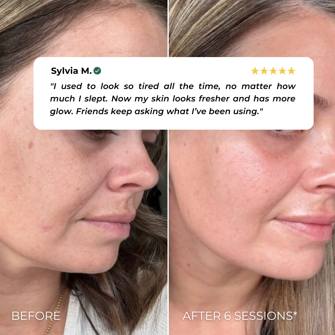 BUEMM K- Beauty Device